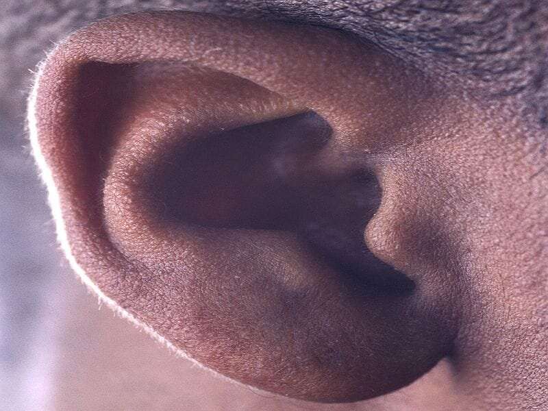 USPSTF: evidence lacking for screening elders for hearing loss