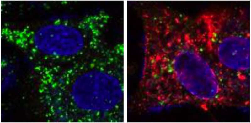 West Nile virus triggers brain inflammation by inhibiting protein degradation