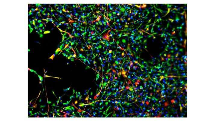 World's first: Drug guides stem cells to desired location, improving their ability to heal