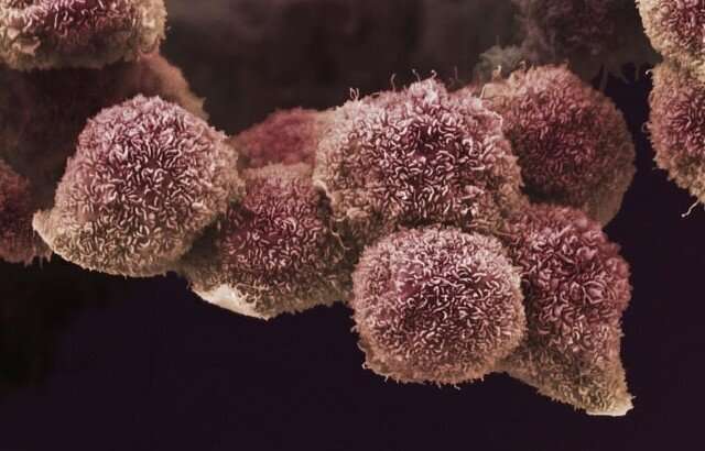 临床试验表明，联合维生素A治疗胰腺癌是安全的