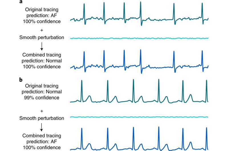 Deep learning electrocardiogram devices found to be susceptible to adversarial attack