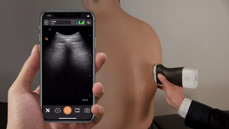 Researchers develop portable ultrasound scanner network for COVID-19