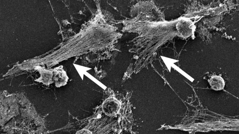 International consortium investigates overactive immune cells as cause of COVID-19 deaths