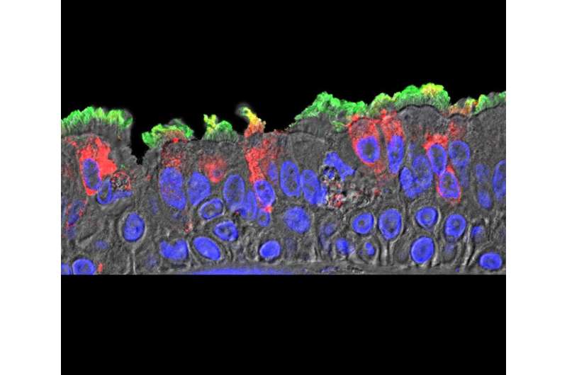 Researchers map SARS-CoV-2 infection in cells of nasal cavity, bronchia, lungs