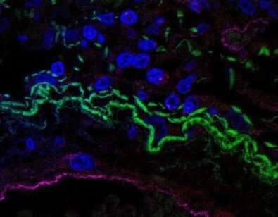 研究揭示了触发Covid-19典型细胞因子风暴的免疫机制
