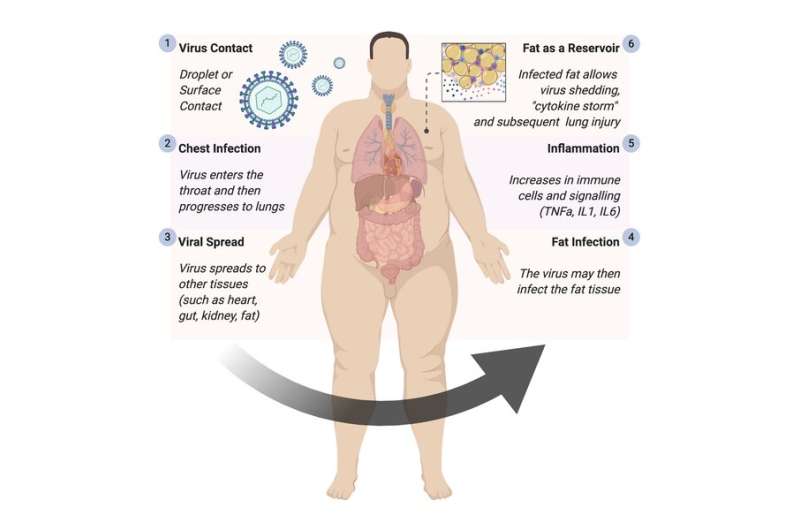 Coronavirus linked to greater risk of life-threatening infection in people with obesity