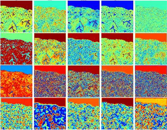 Deep learning accurately stains digital biopsy slides