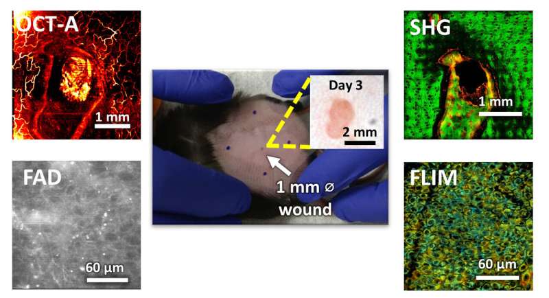 Researchers develop microscopy technique for noninvasive evaluation of wound healing