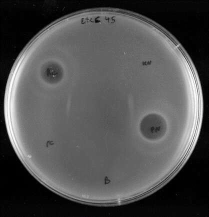 Researchers design new antibacterial agent against Escherichia coli bacteria