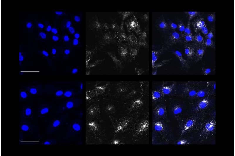 Alzheimer's risk gene disrupts endocytosis, but another disease-linked gene could help