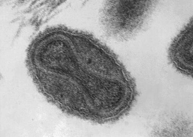 A massive public health effort eradicated smallpox but scientists are still studying the deadly virus