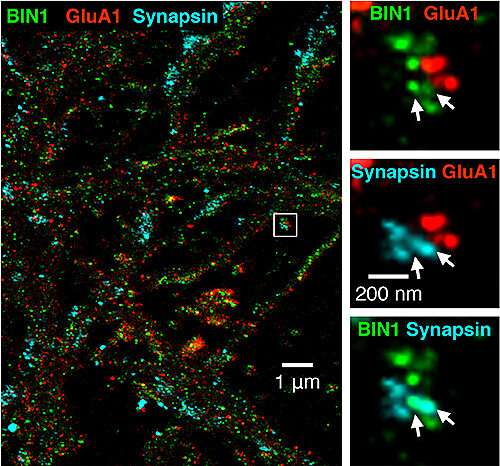 BIN1 deficit impairs brain cell communication, memory consolidation