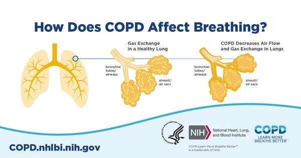 Cigarette smoke can reprogram cells in your airways, causing COPD to hang on after smoking ends