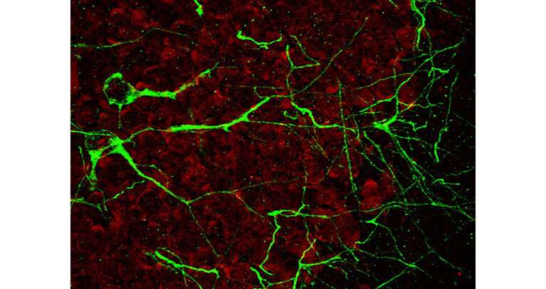 Focused ultrasound shown to enhance the delivery of promising therapeutic for Alzheimer's disease