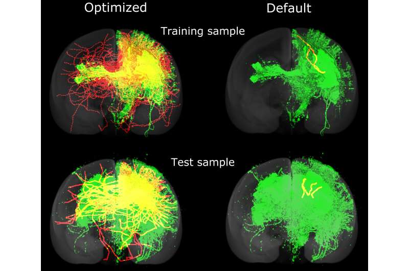 Machine intelligence accelerates research into mapping brains