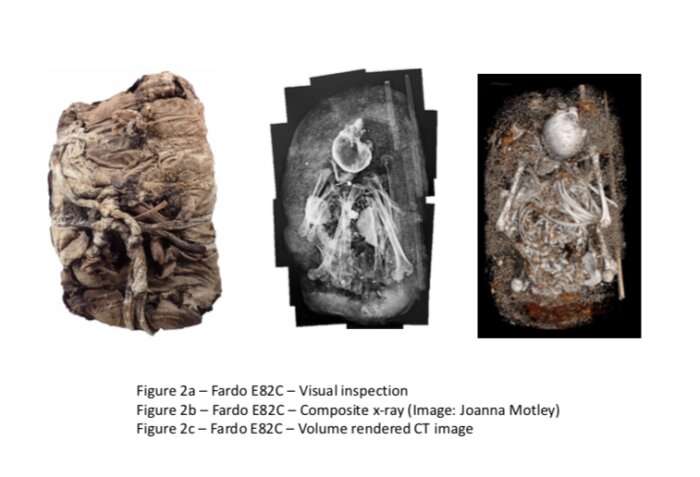 Mosaic X-rays reveal Peruvian mummy mysteries