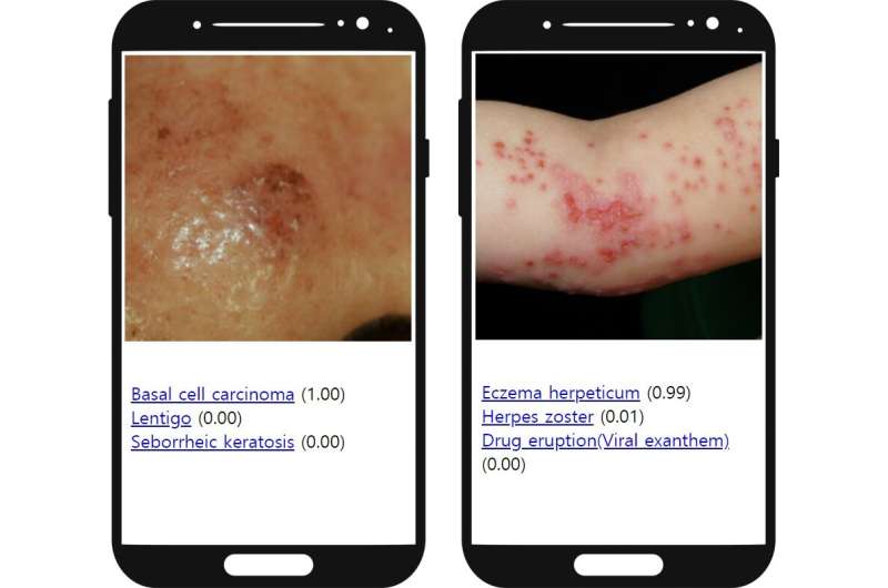 New artificial intelligence system can empower medical professionals in diagnosing skin diseases