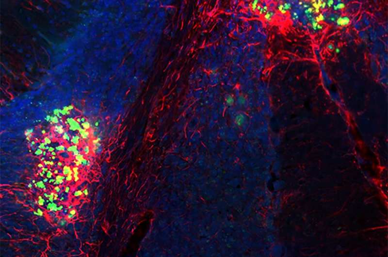 Persistence of Zika virus in the brain causes long-term problems in mice