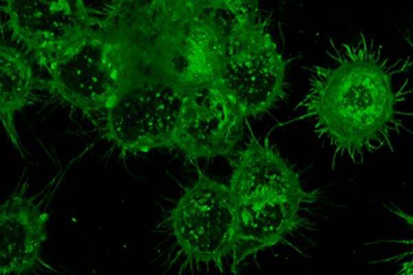Potential treatment approach kills lymphoma while sparing healthy cells