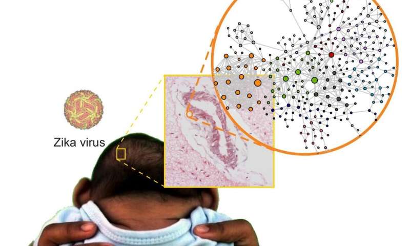 Study identifies how infection by Zika virus during pregnancy can affect the fetal brain