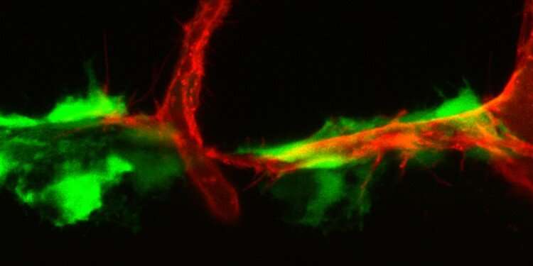 Researchers identify 'hot spots' for developing lymphatic vessels