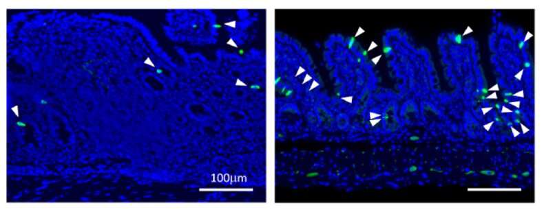 Research shows stimulating tuft cell production reverses intestinal inflammation
