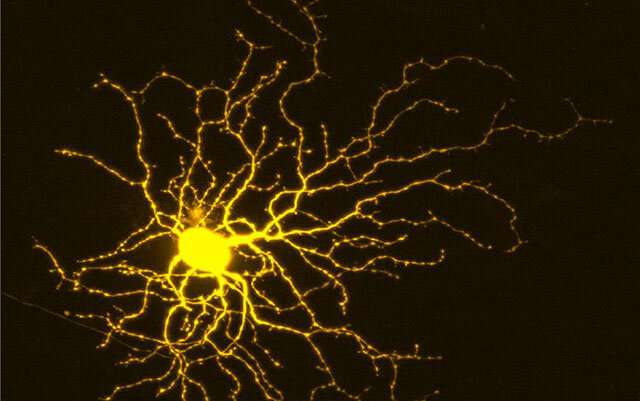 Researchers discover clue to how to protect neurons and encourage their growth