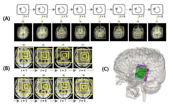 Deep learning helps explore the structural and strategic bases of autism?
