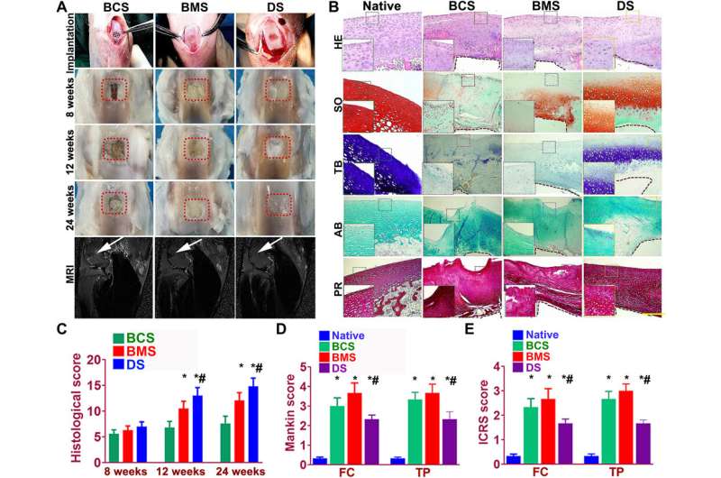 3-D bioprinting constructs for cartilage regeneration