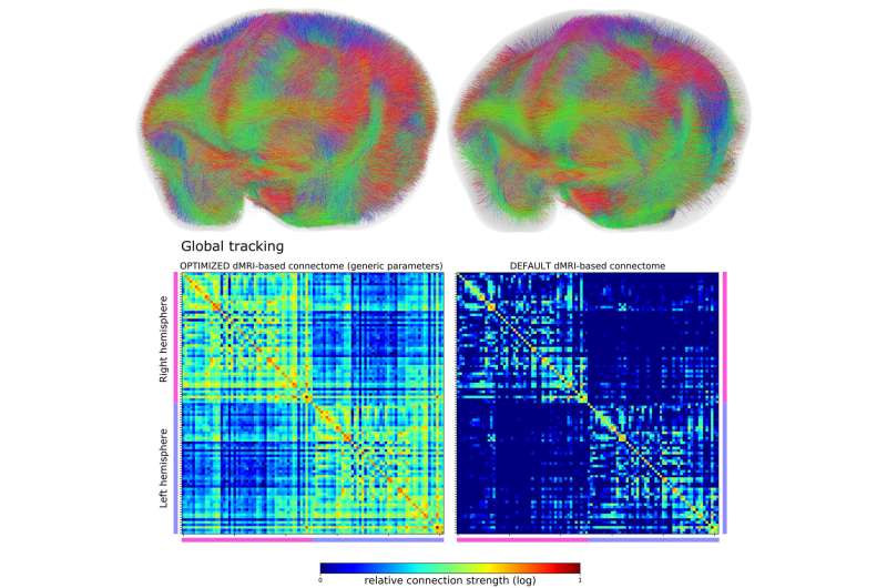 Machine intelligence accelerates research into mapping brains