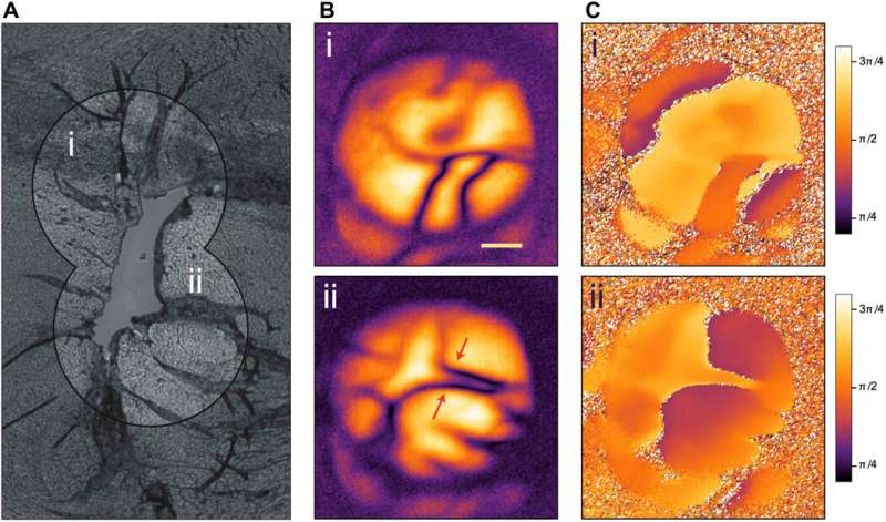 Microscopy with undetected photons in the mid-infrared region