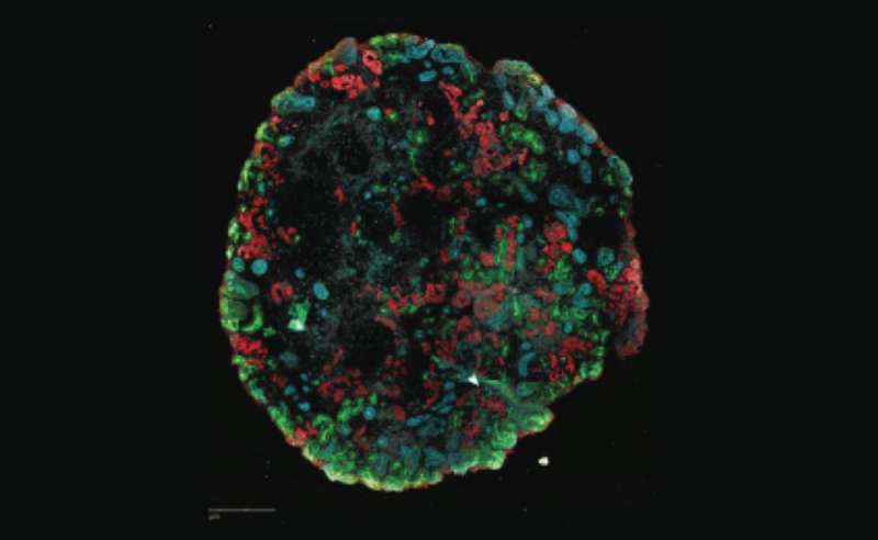 Organoids emerge as powerful tools for disease modeling and drug discovery