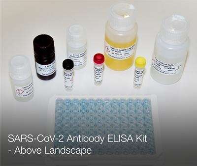 Research helps deliver high quality COVID-19 antibody test