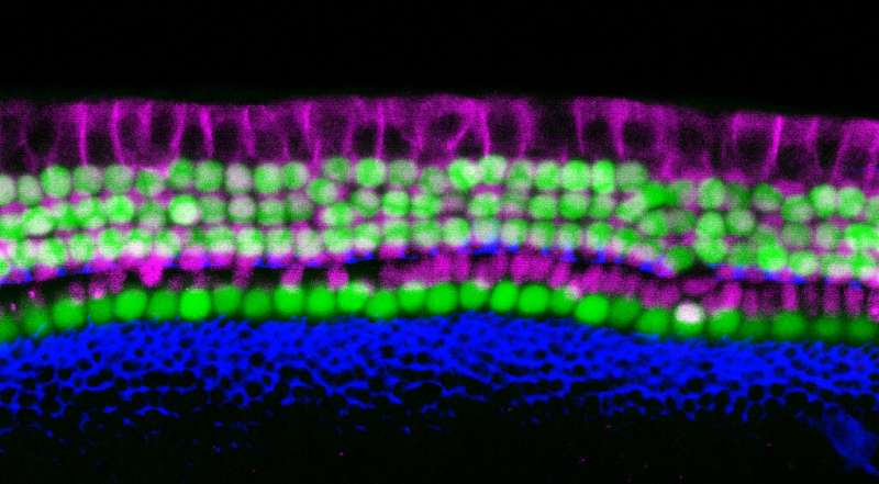 Scientists find a simpler way to make sensory hearing cells