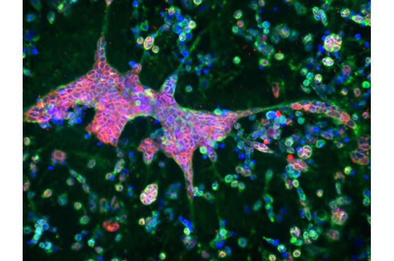 3D brain-like tissue model links Alzheimer's disease with herpes