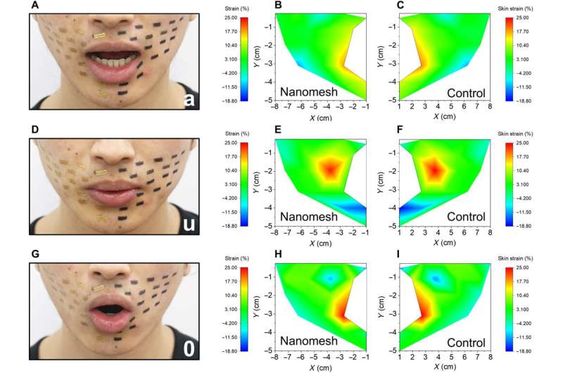 An on-skin durable nanomesh sensor to monitor natural skin motion