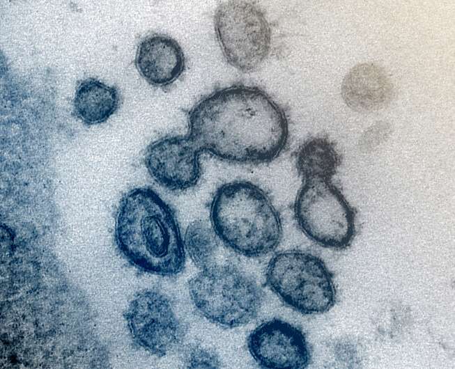 coronavirus , COVID-19