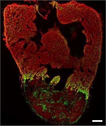 Heart muscle cells change their energy source during heart regeneration