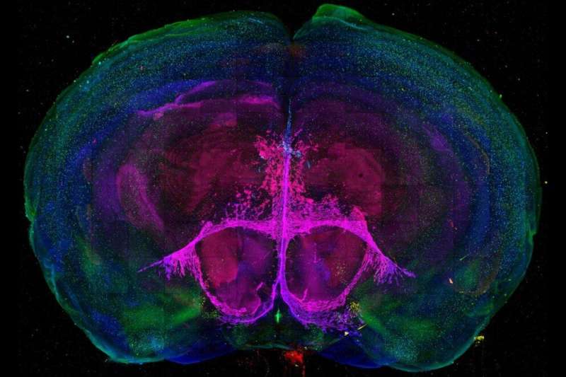 Researcher develops method for mapping brain cell change, development in mice