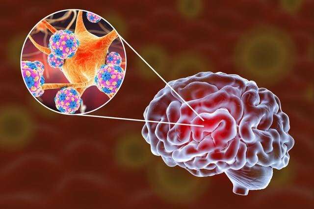 Scientists prove SARS-CoV-2 potential to infect human brain organoids