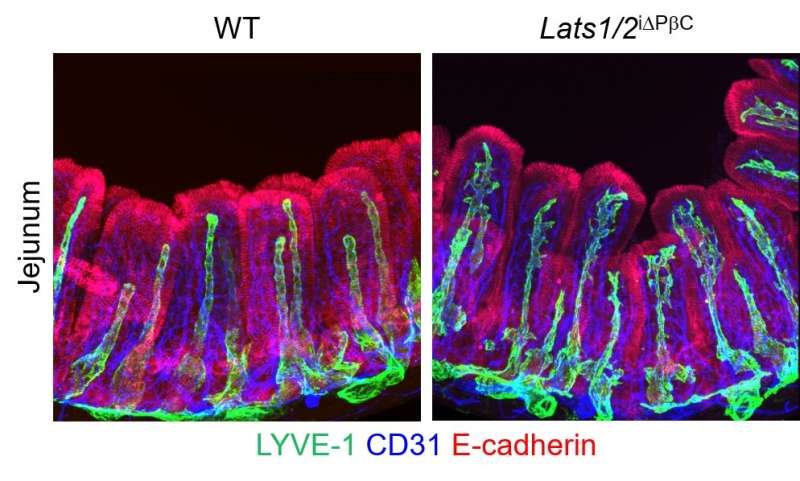 Newly identified gut cells nurture lymph capillaries