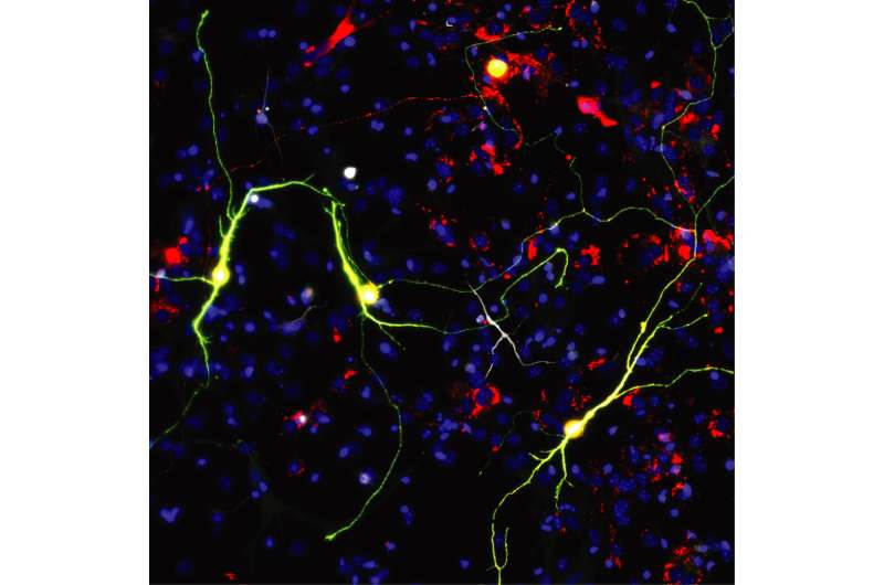 Researchers improve neuronal reprogramming by manipulating mitochondria