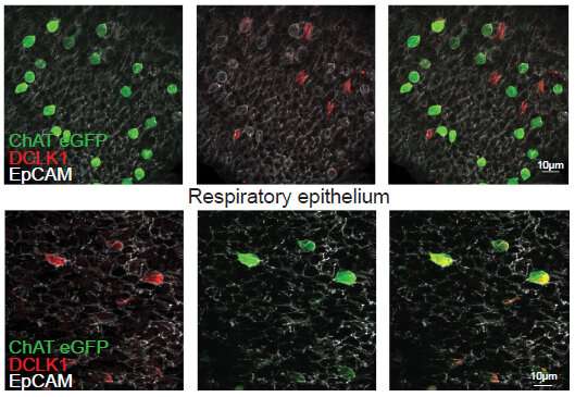 Brush cells in the nose found to secrete proinflammatory lipids