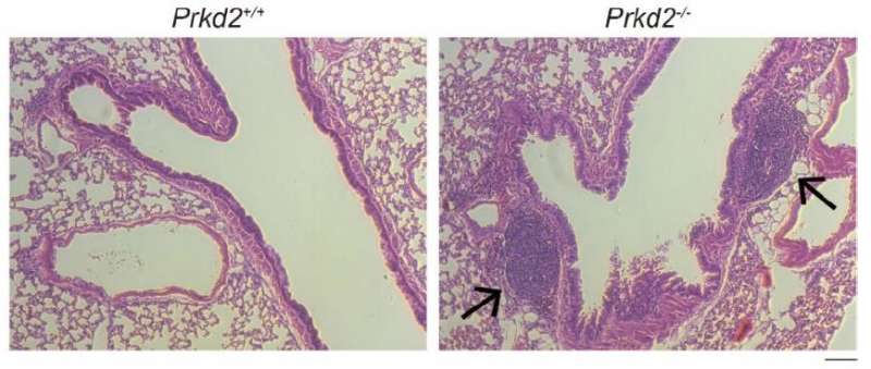 Gene responsible for controlling activity of T follicular cells identified