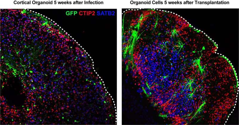 Not 'brains in a dish': Cerebral organoids flunk comparison to developing nervous system