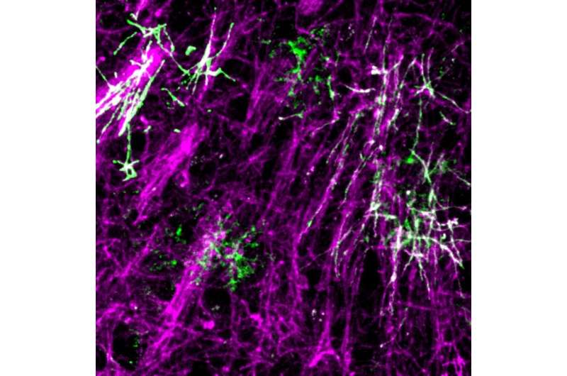 Long-term learning requires new nerve insulation