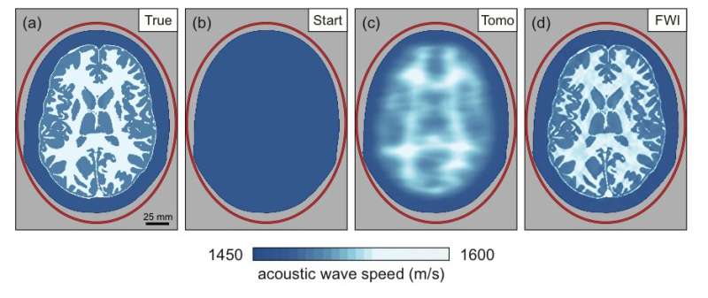 Seismic imaging technology could deliver finely detailed images of the human brain