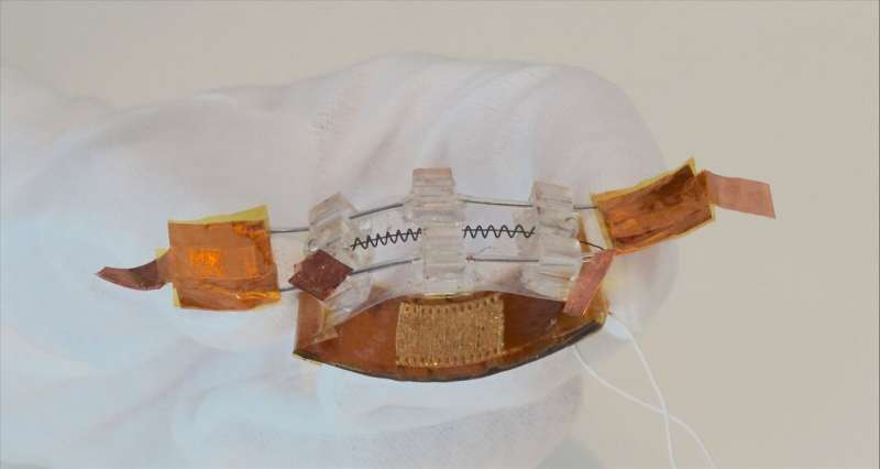 Researchers develop novel device to improve performance of underactive bladders