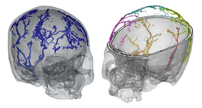 A study analyzes the growth and development of the diploic veins in modern humans