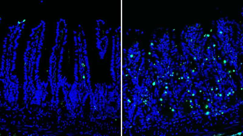 Intestinal health: Dresden research team identifies enzyme essential for stem cell survival